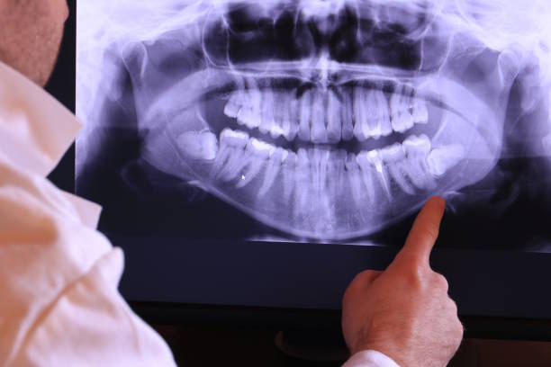 Best Emergency Dentist for Special Needs Patients in Leavenworth, KS