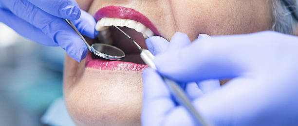 Best Emergency Dentist for Knocked-Out Tooth in Leavenworth, KS